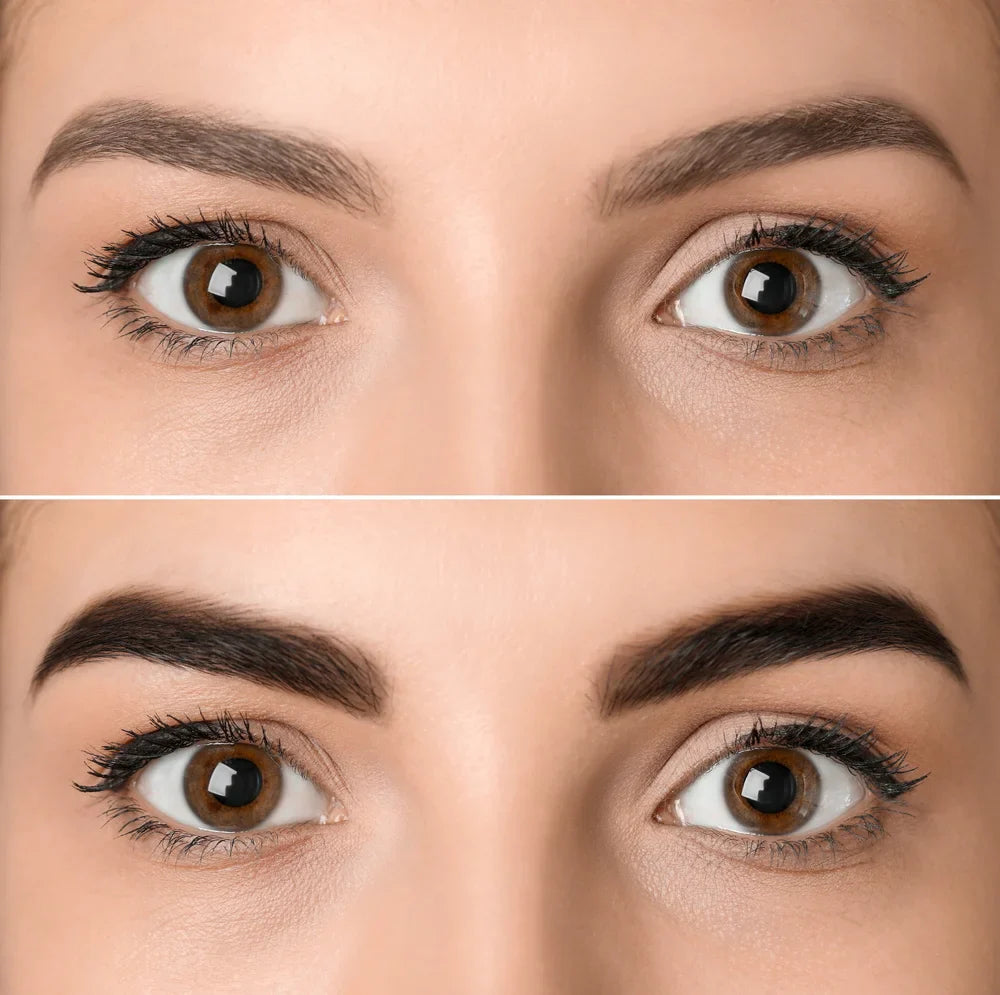 Cejas